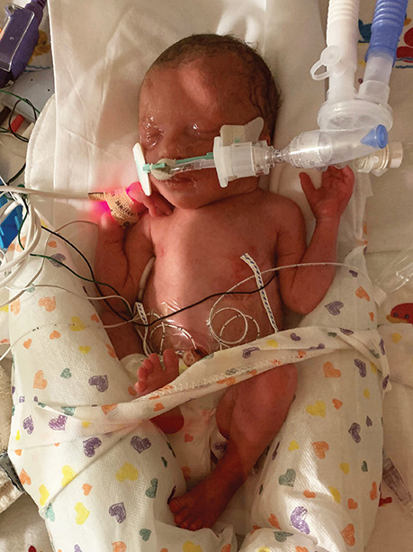 Gracelyn in NICU