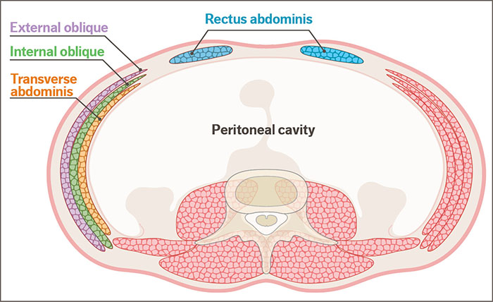 Hernia Repair