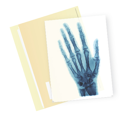 x-ray of hand