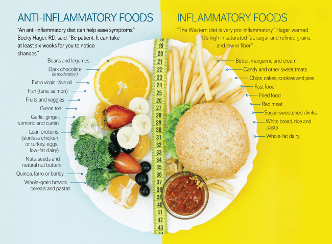 side-by-side chart showing examples anti-inflammatory and inflammatory foods